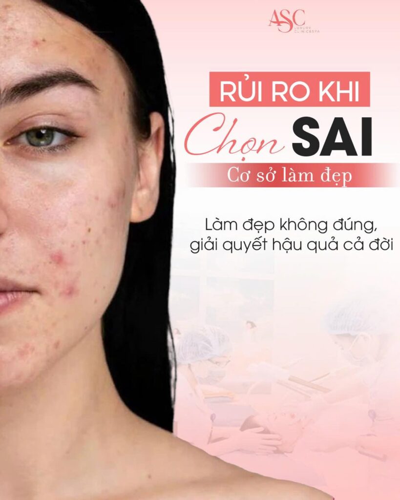 Rủi ro khi chọn sai phương pháp trị nám 